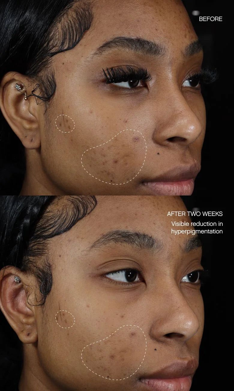 Faded Brightening + Clearing Serum