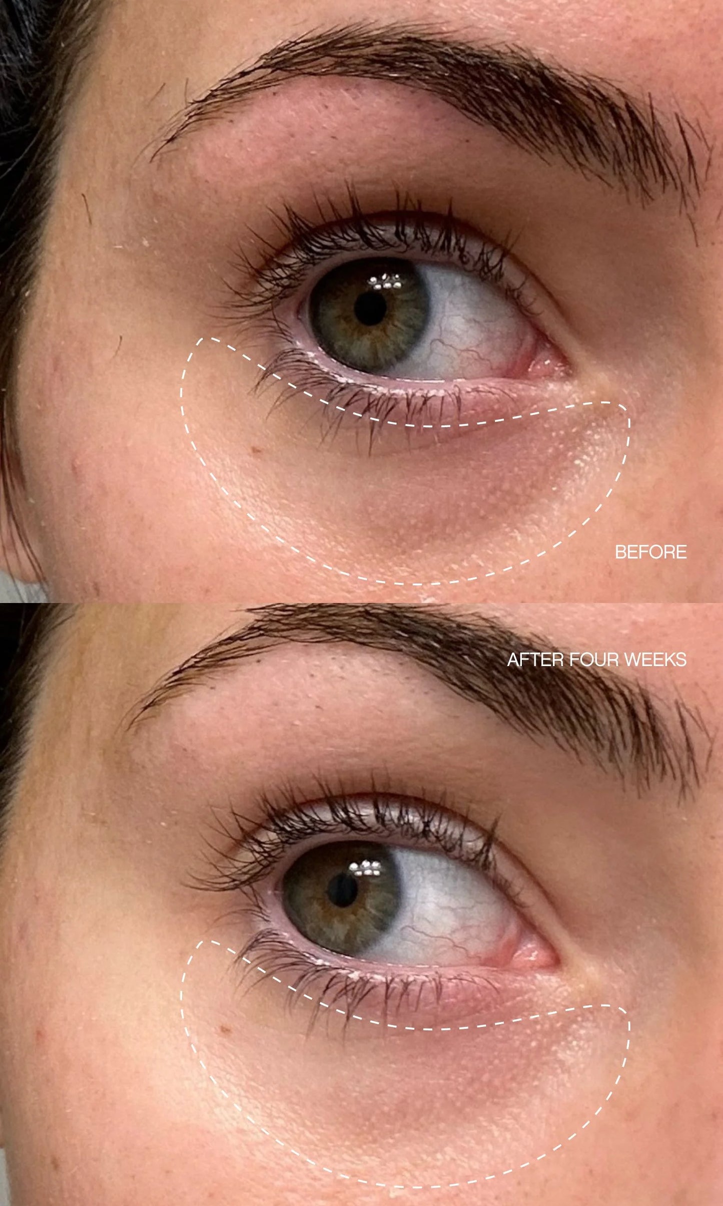 Faded Complete Dark Spot Bundle