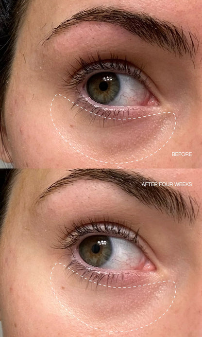 Faded Complete Dark Spot Bundle