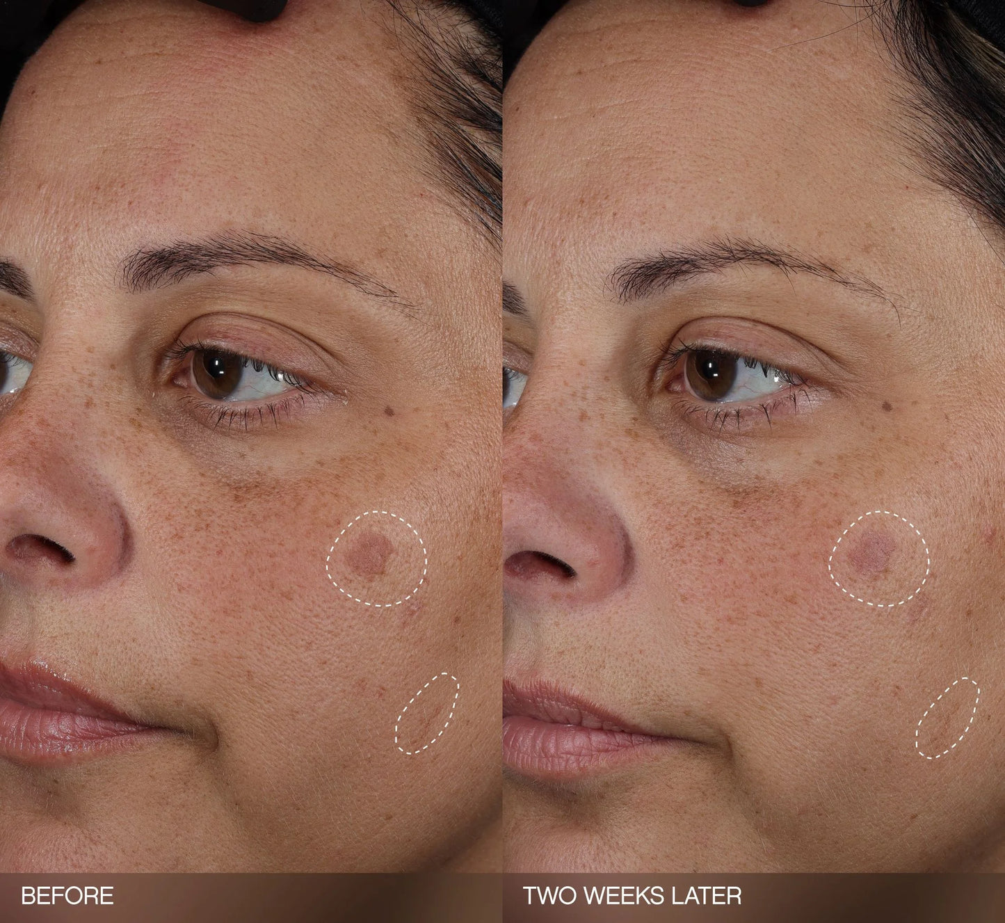 Faded Complete Dark Spot Bundle