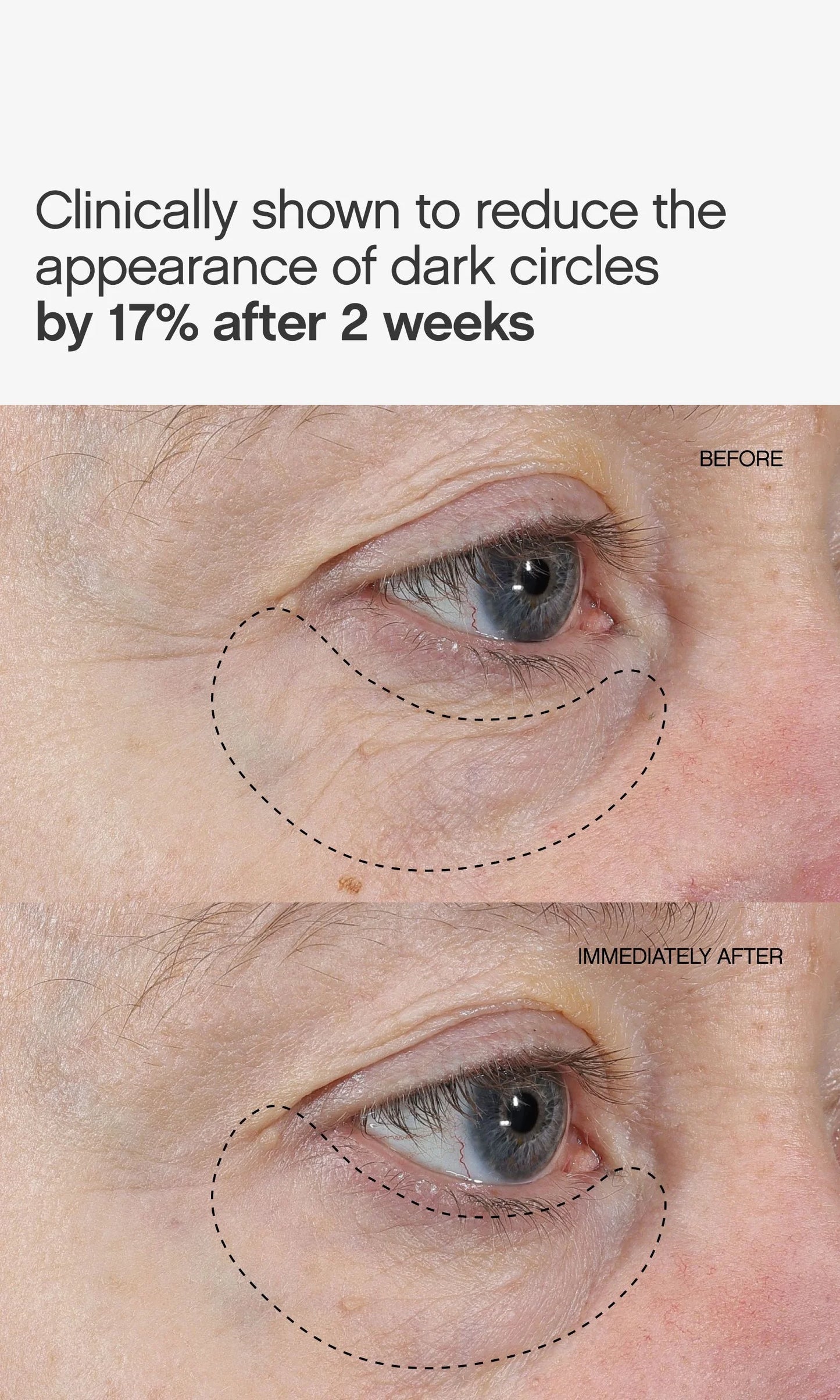 Faded Under Eye Masks