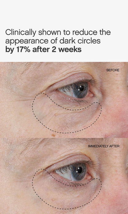 Faded Under Eye Masks