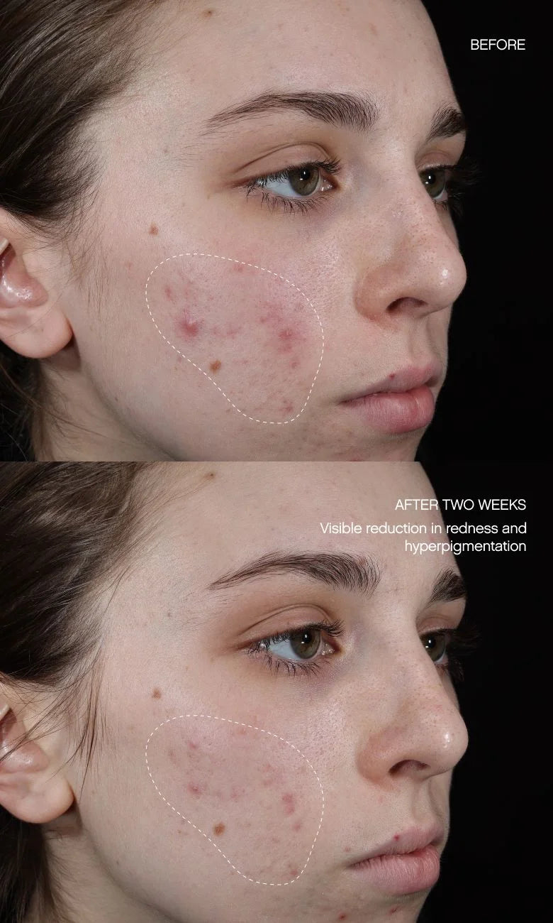 Faded Brightening + Clearing Serum