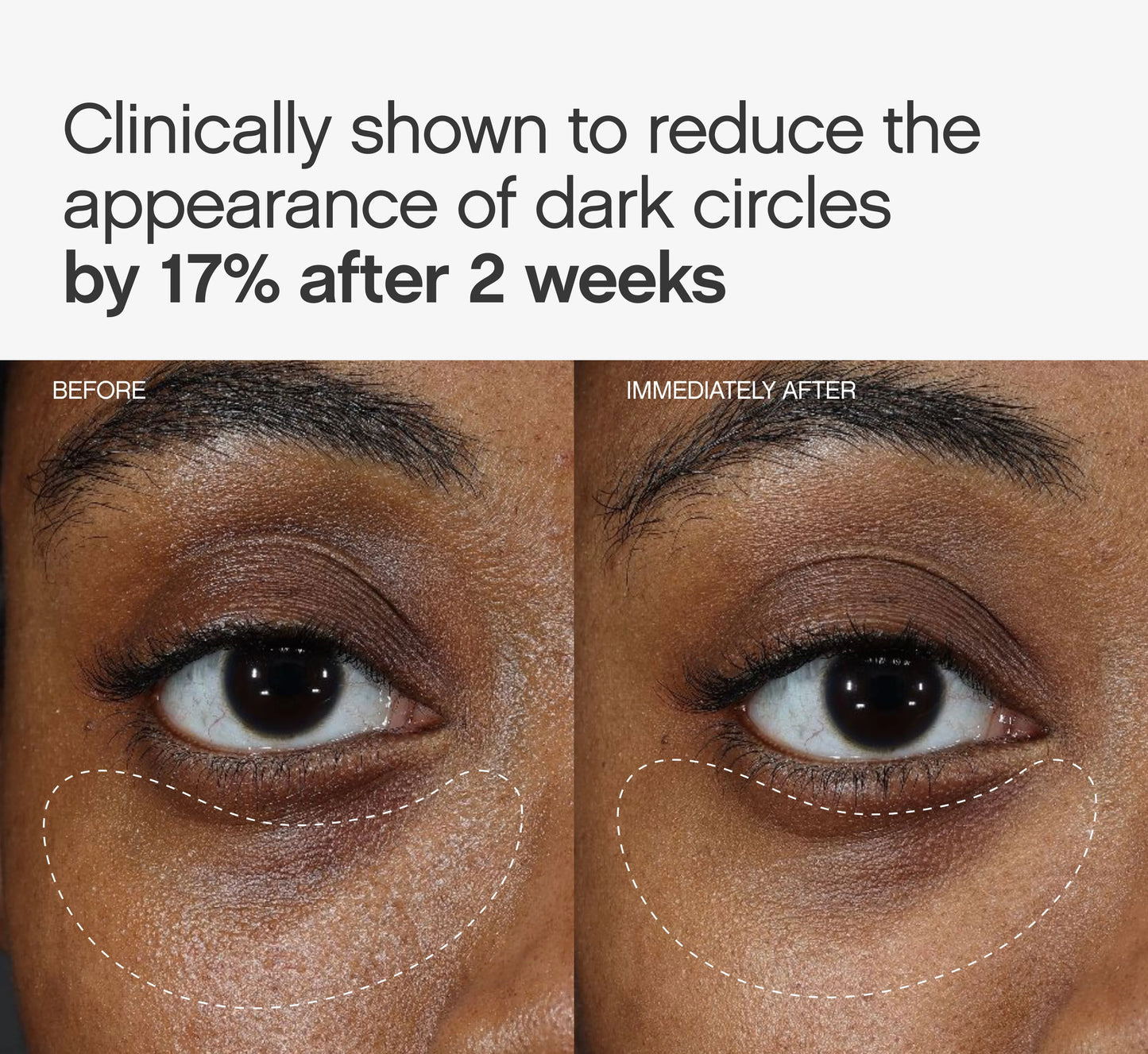 Faded Under Eye Masks