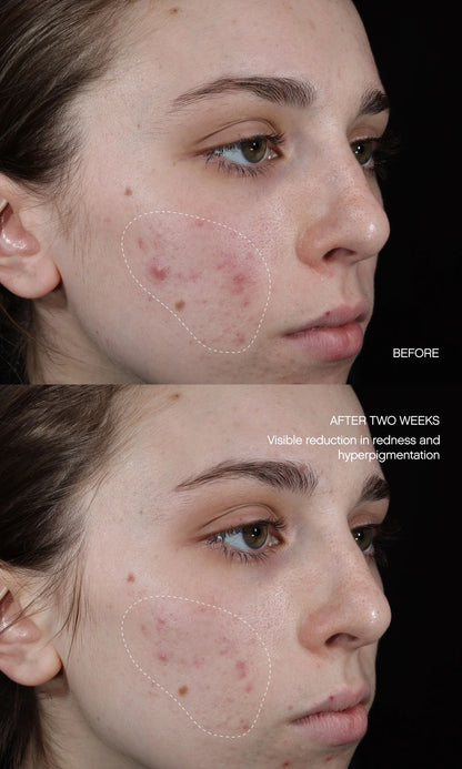Faded Serum (Original Formula)